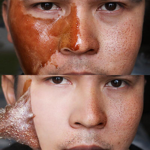 Honey tearing mask Peel